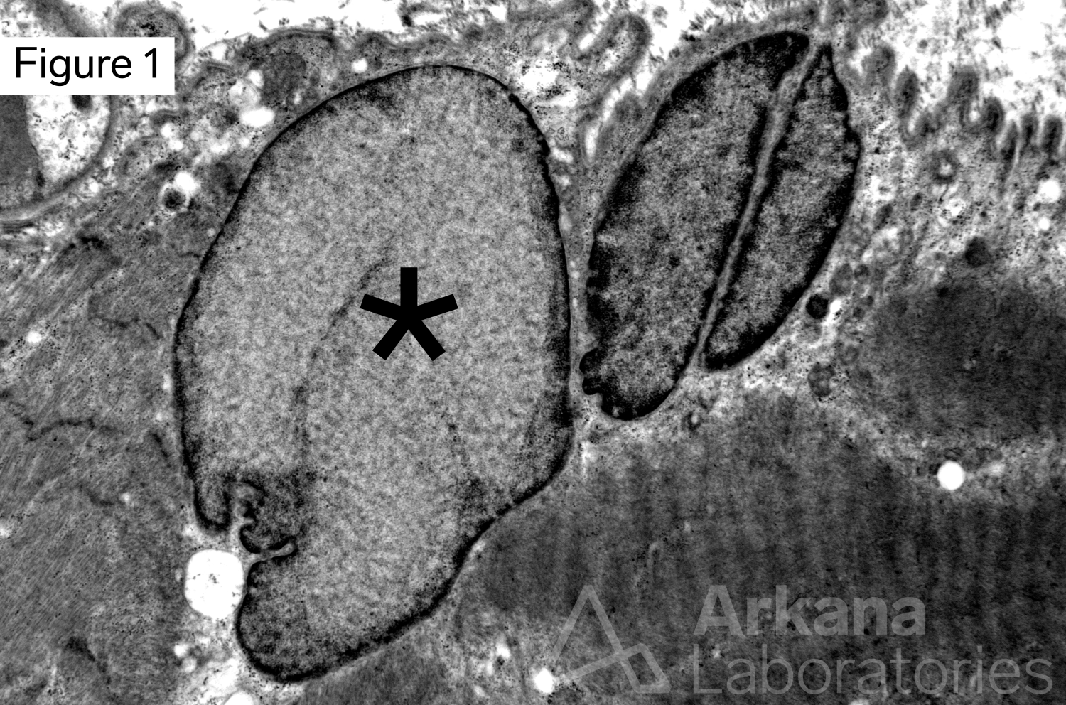 Figure 1 (with astrick)