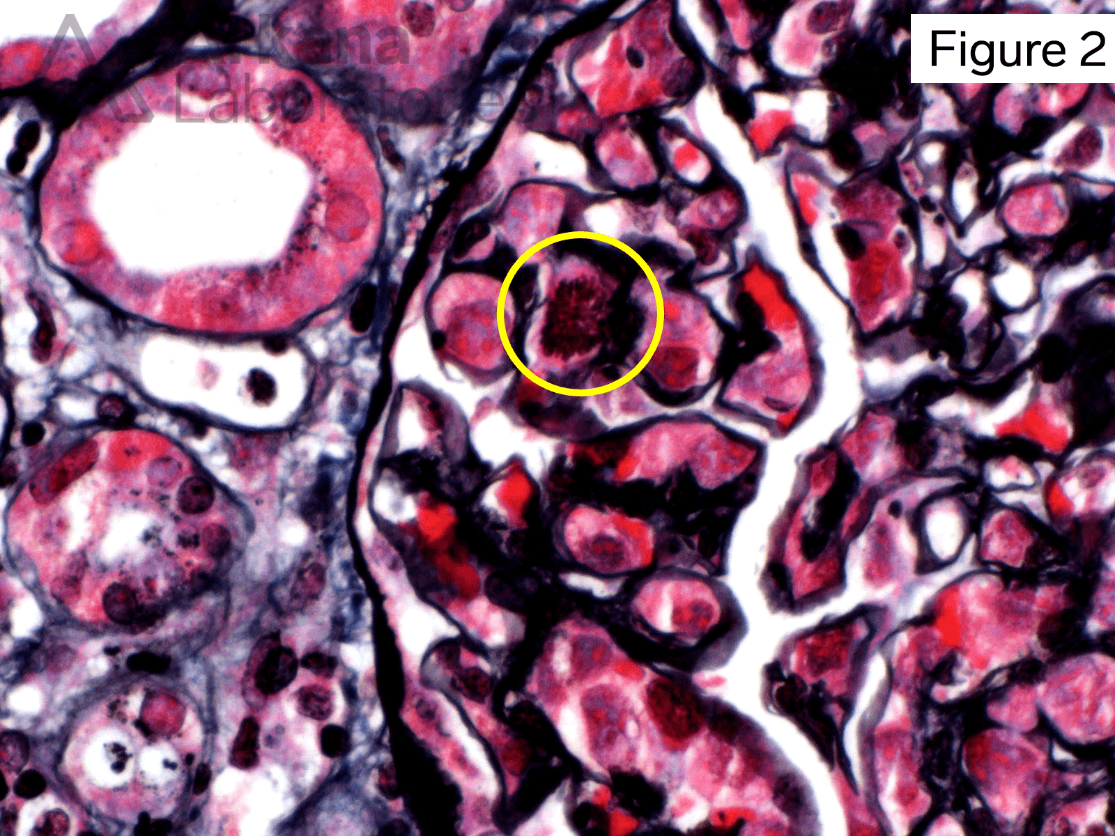 These cells also showed frequent mitosis