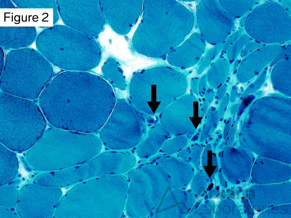 muscle fibers with internalized nuclei