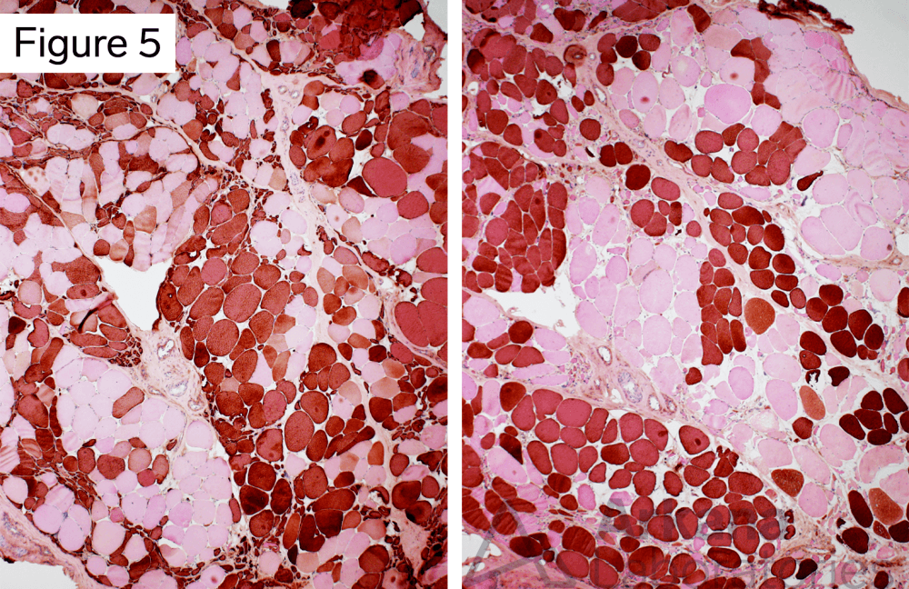 These lower magnification images show groups of Type 2 (dark on MHCf) and Type 1 (dark on MHCs) muscle fibers.