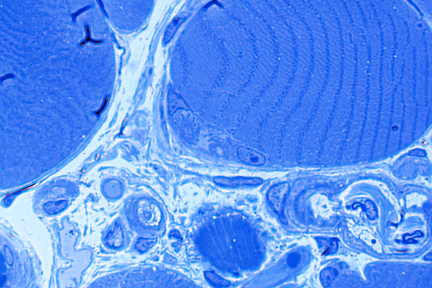 neuromuscular junction