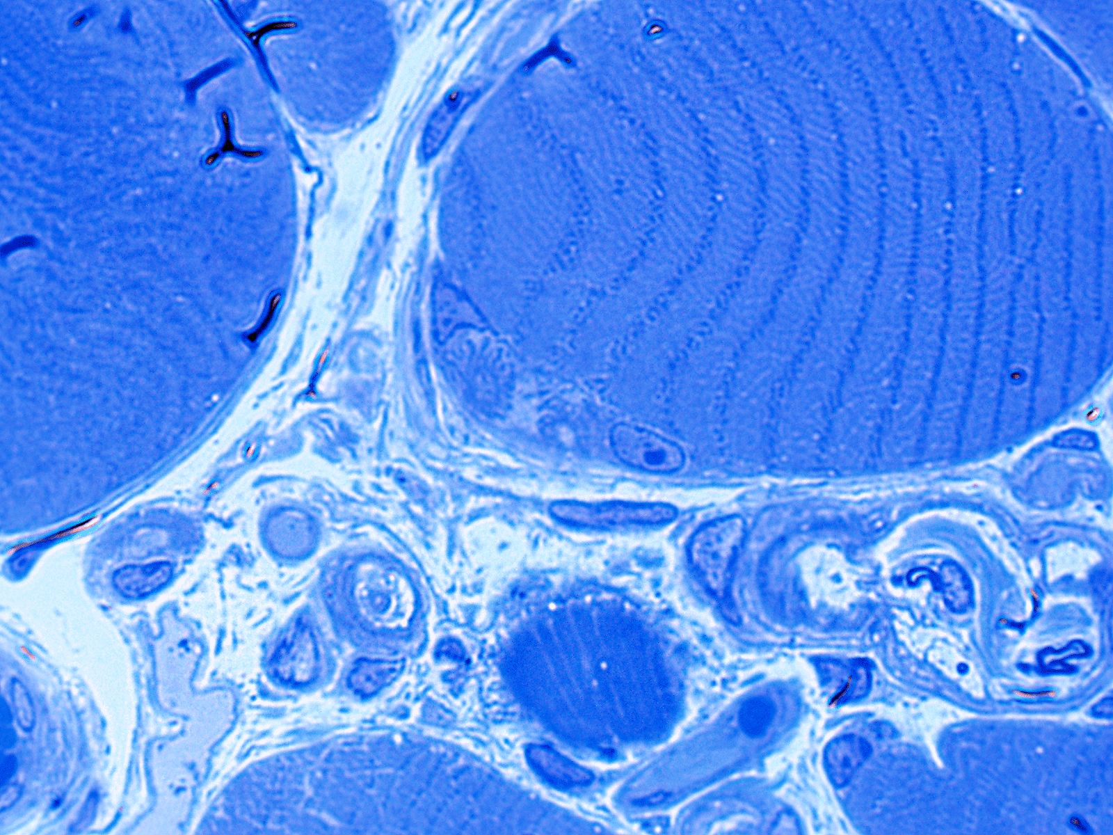 neuromuscular junction