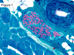 Peripheral Nerve Fascicle