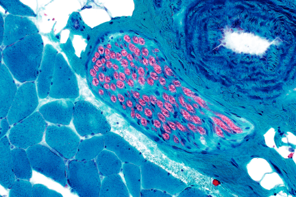 Peripheral Nerve Fascicle