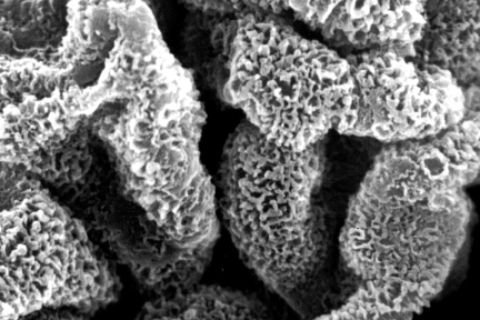 Glomerular Capillary Loops