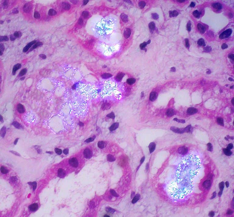 Polaeizable Case 4: A Polarizable Precipitate - Arkana Laboratories