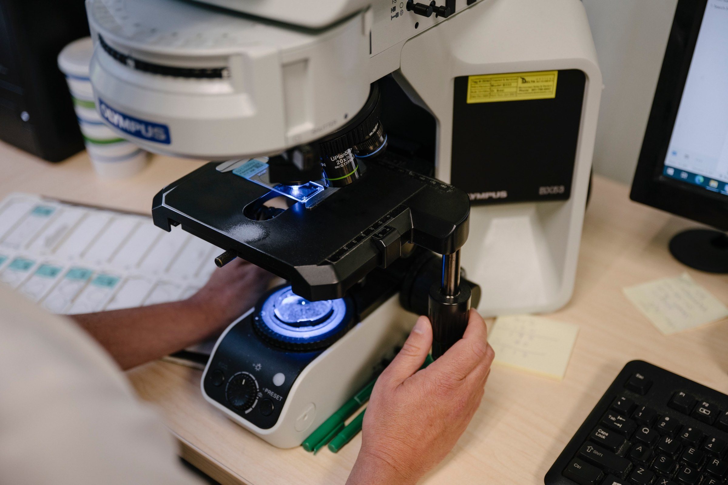 microscope with slide of renal biopsy