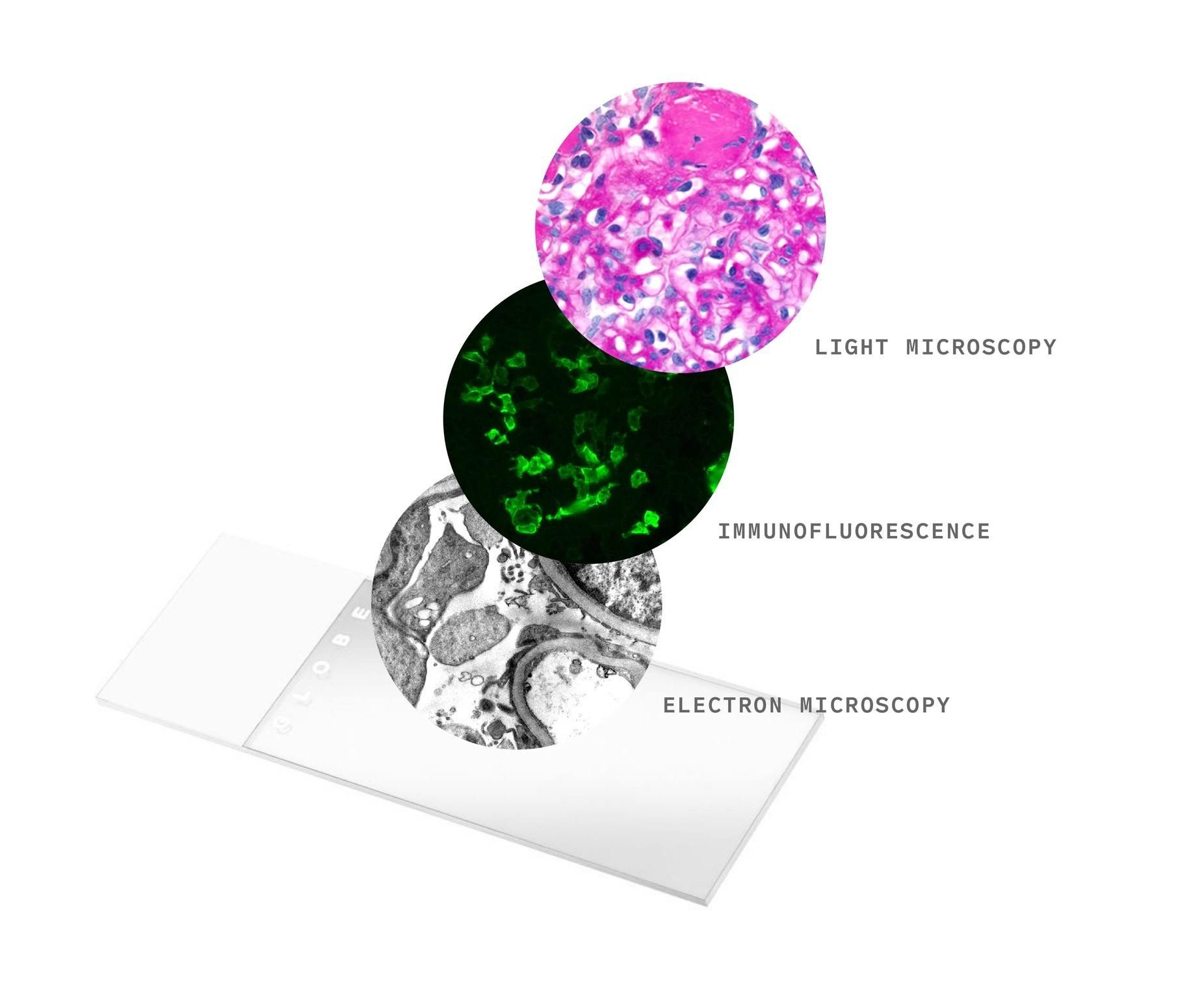 Renal Pathology Lab at Arkana Laboratories