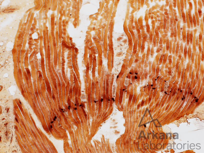 NMJ neonatal muscle