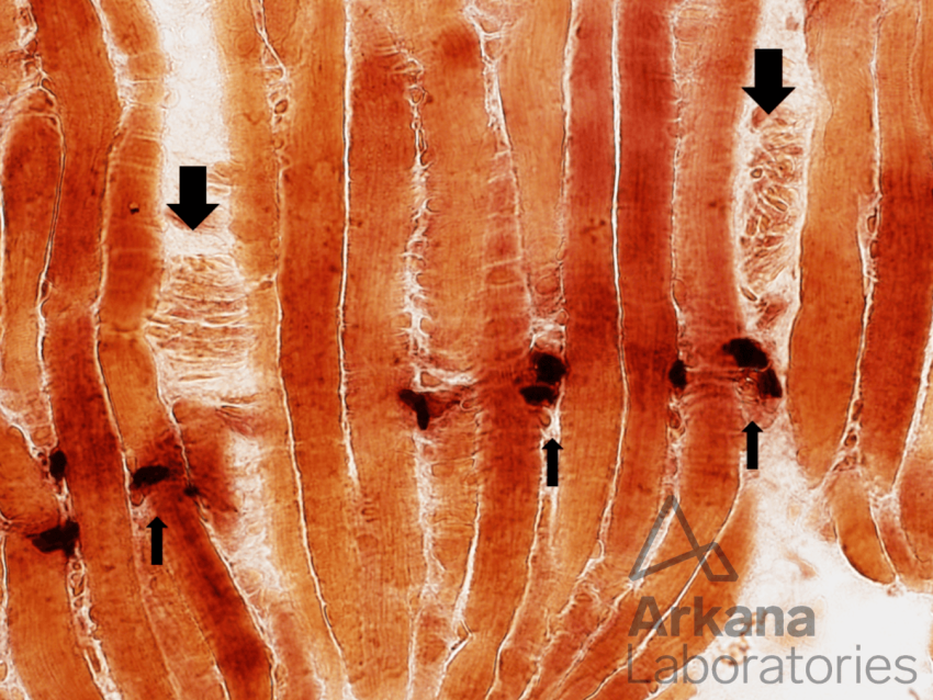 NMJ neonatal muscle