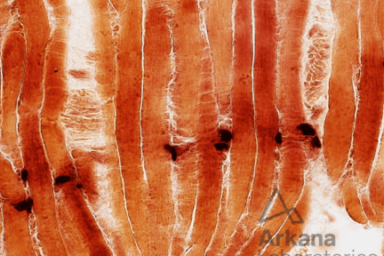 NMJ neonatal muscle