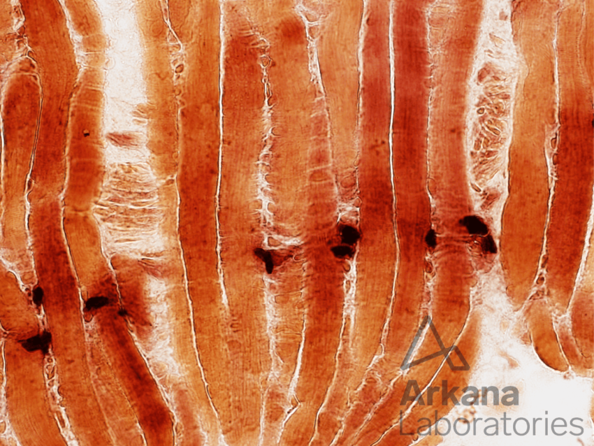 NMJ neonatal muscle