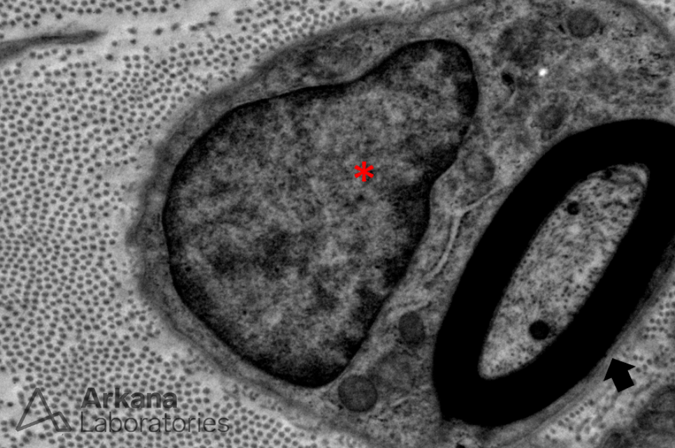 peripheral nerve axons