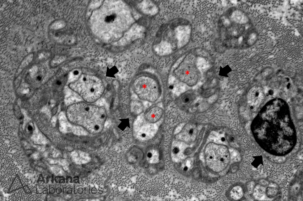 Peripherial nerve axons