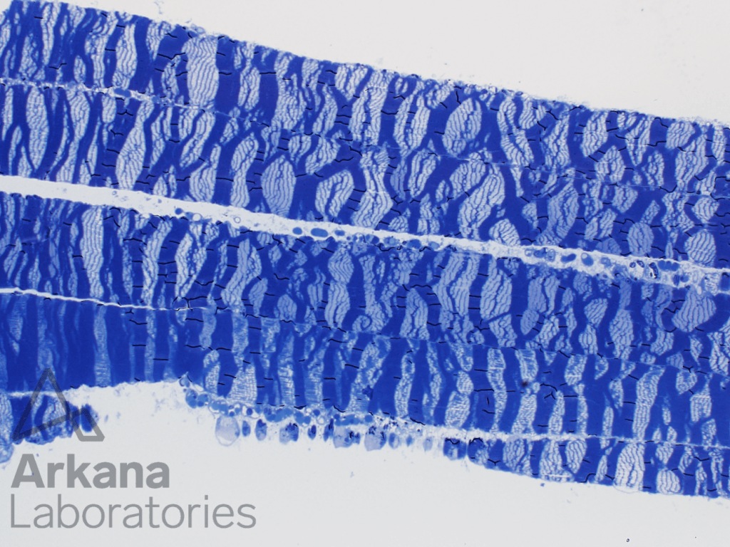 Toluidine blue stained thick section 200x original magnification, Contraction Band