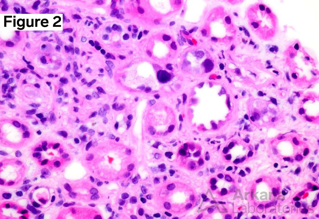 Viral Inclusion Bodies - an overview