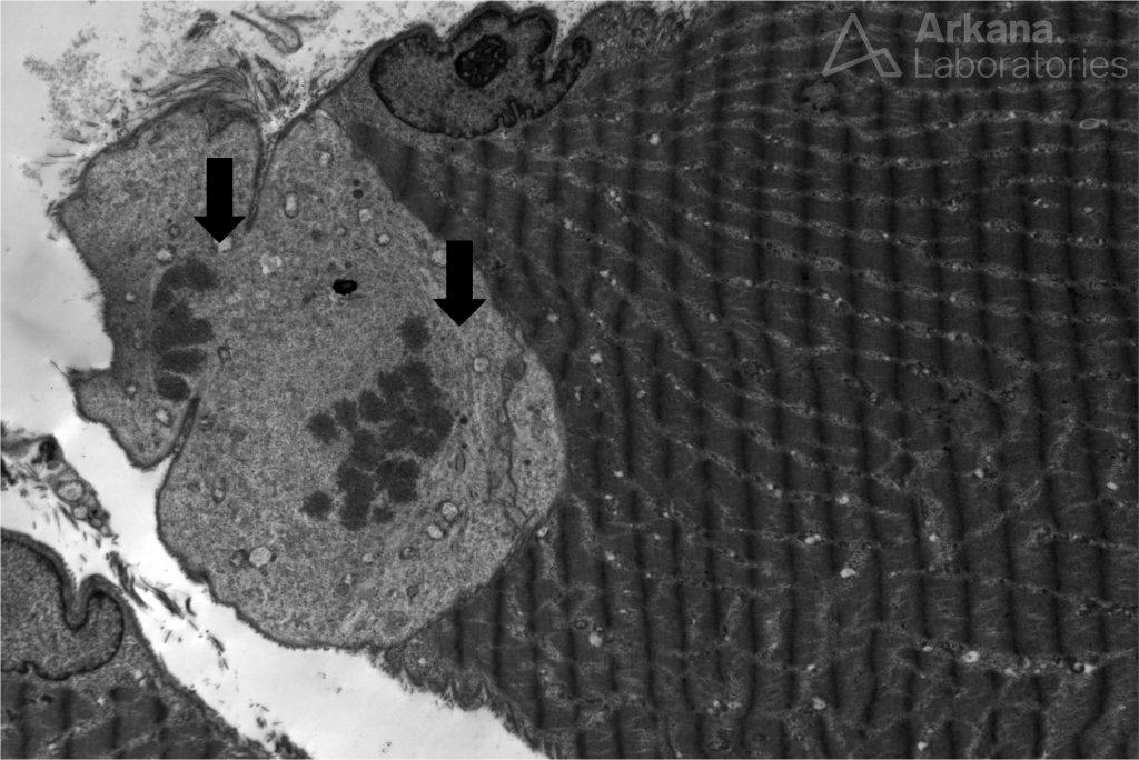 Satellite cells