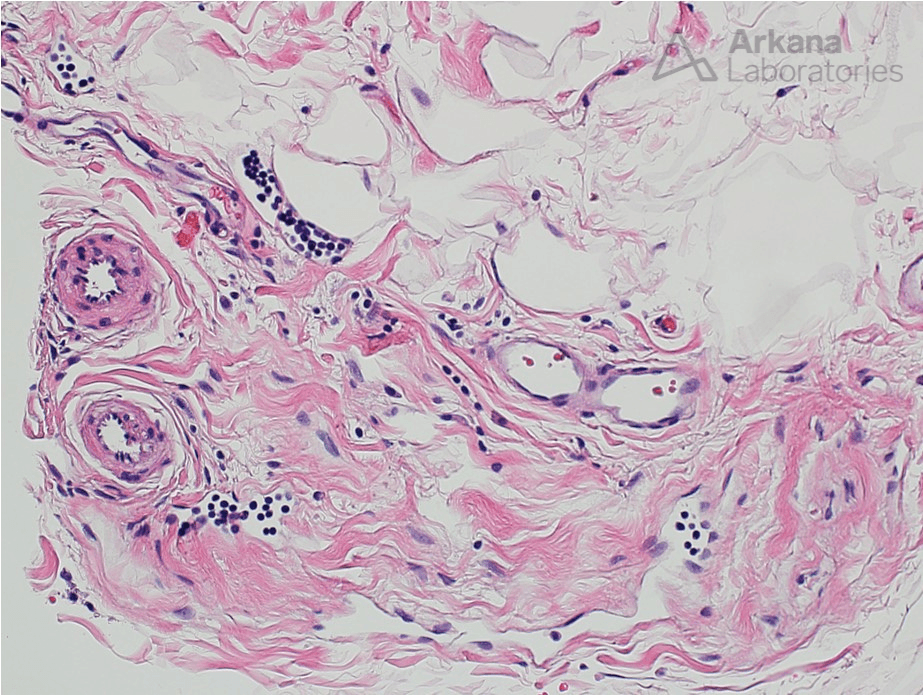 Lymphatic spaces. Arterioles, venules and lymphatics