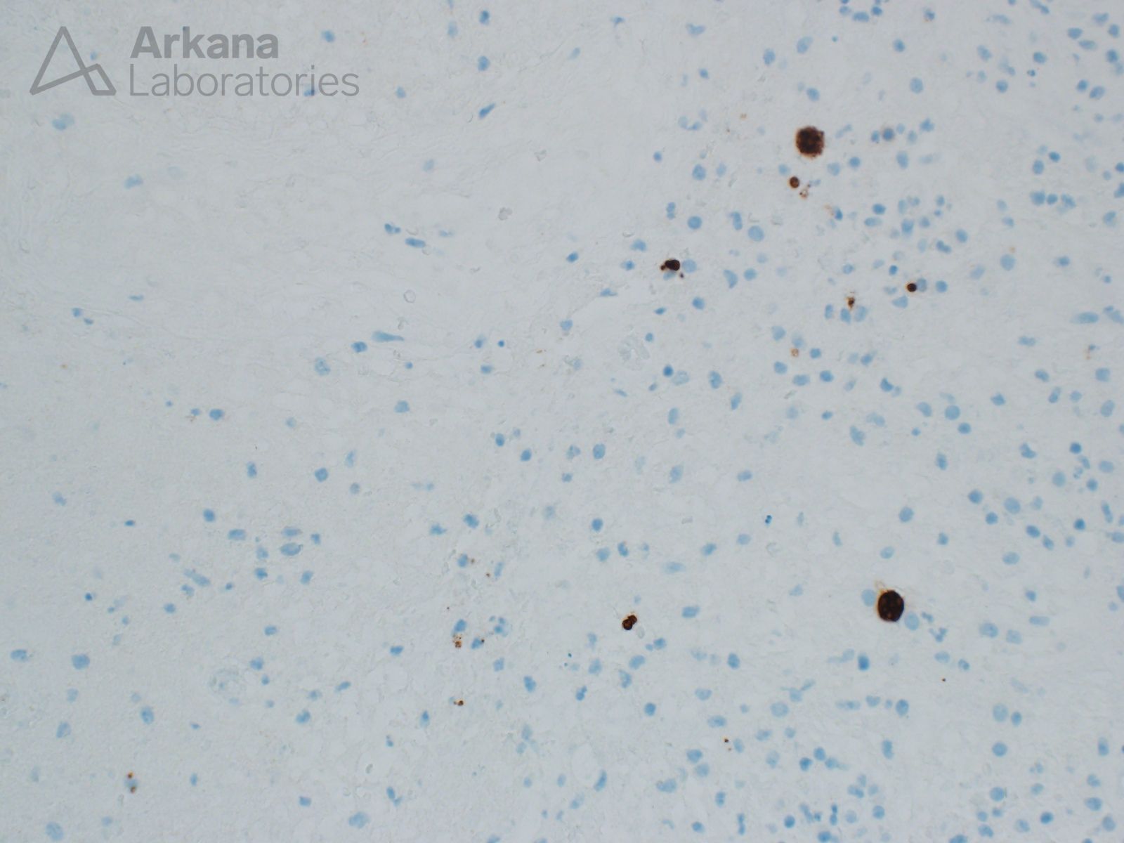 Toxoplasma gondii