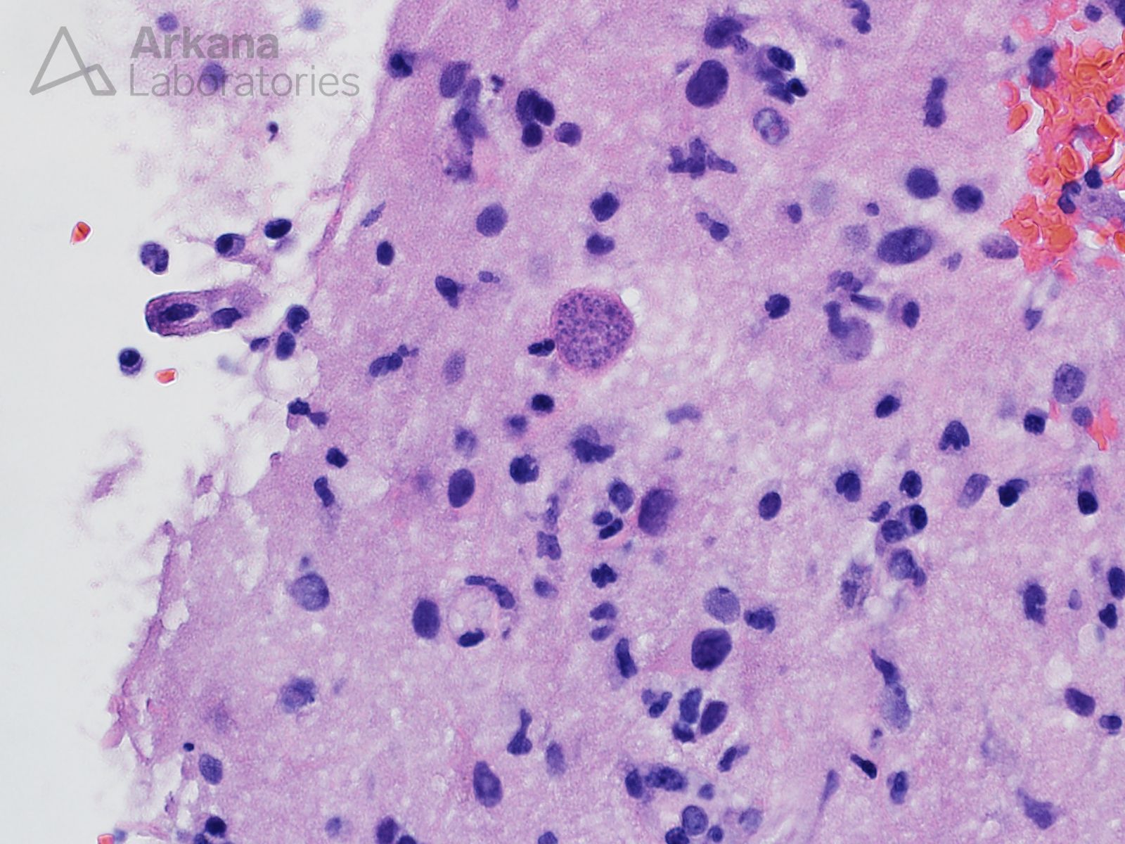 Toxoplasma gondii