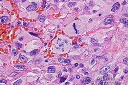 mitotic figure