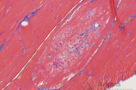 M25-00400_FFPE_Masson_Trichrome