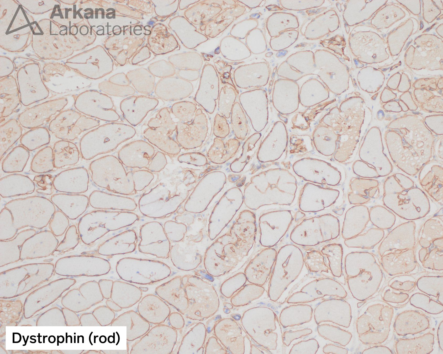 Dystrophin (rod)