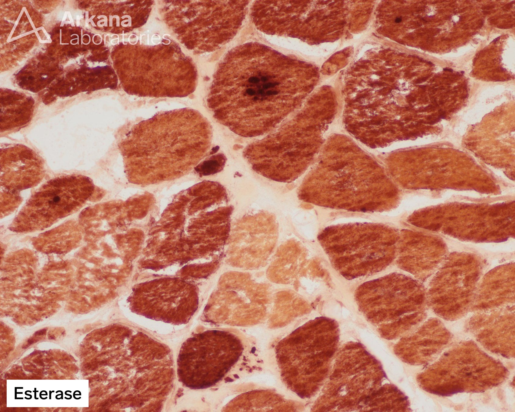 Esterase