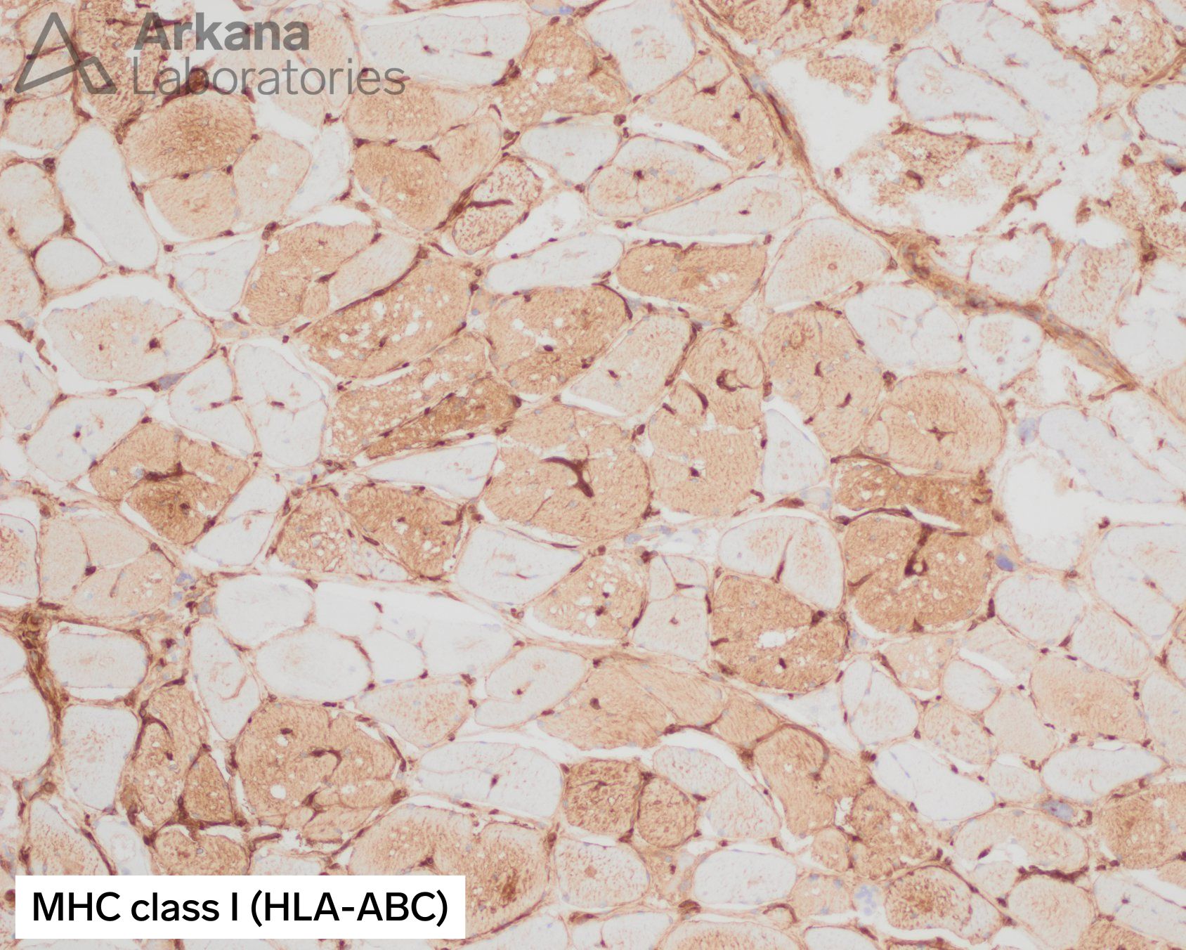 MHC class I (HLA-ABC)