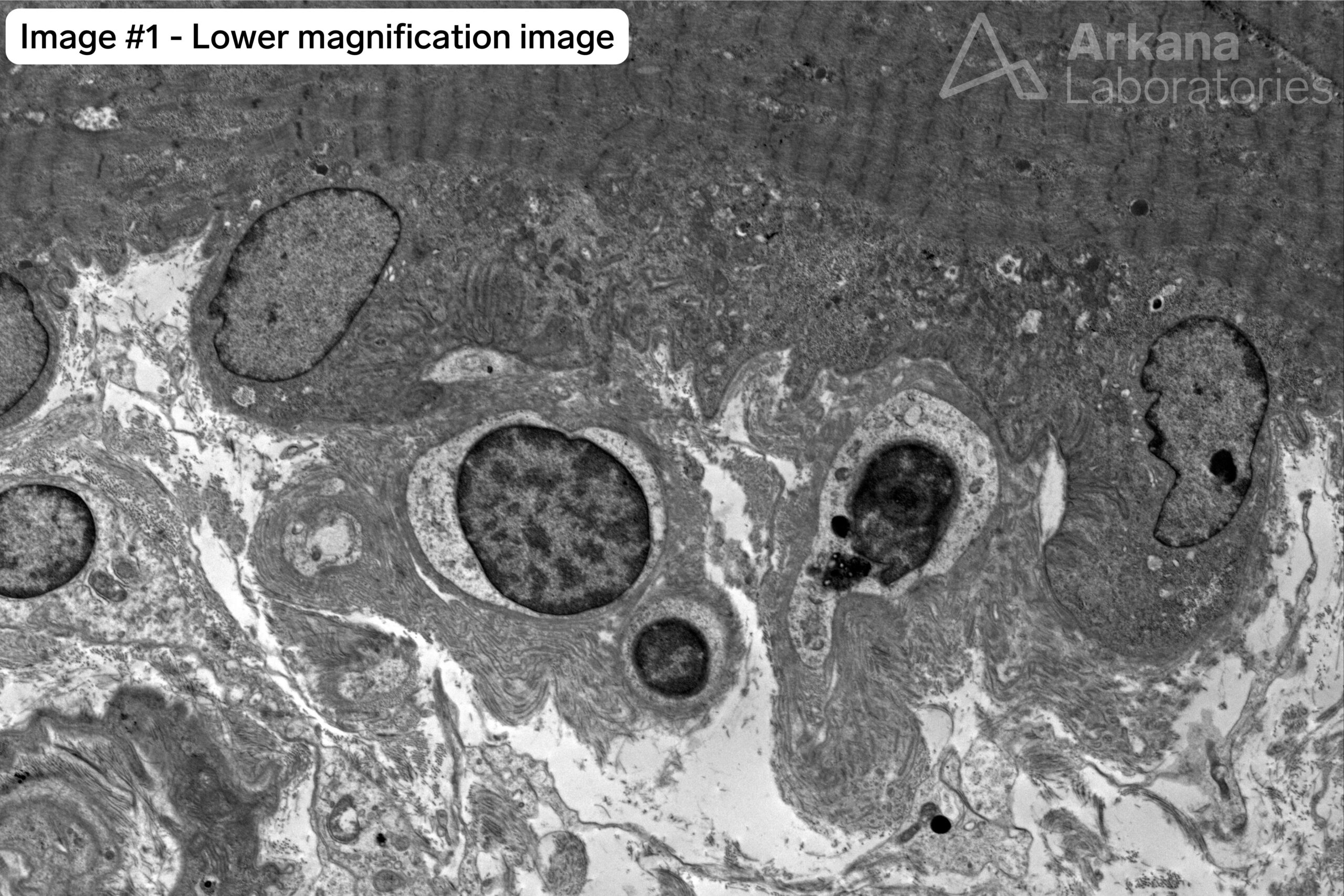 denervated neuromuscular junctions 1 wtmk
