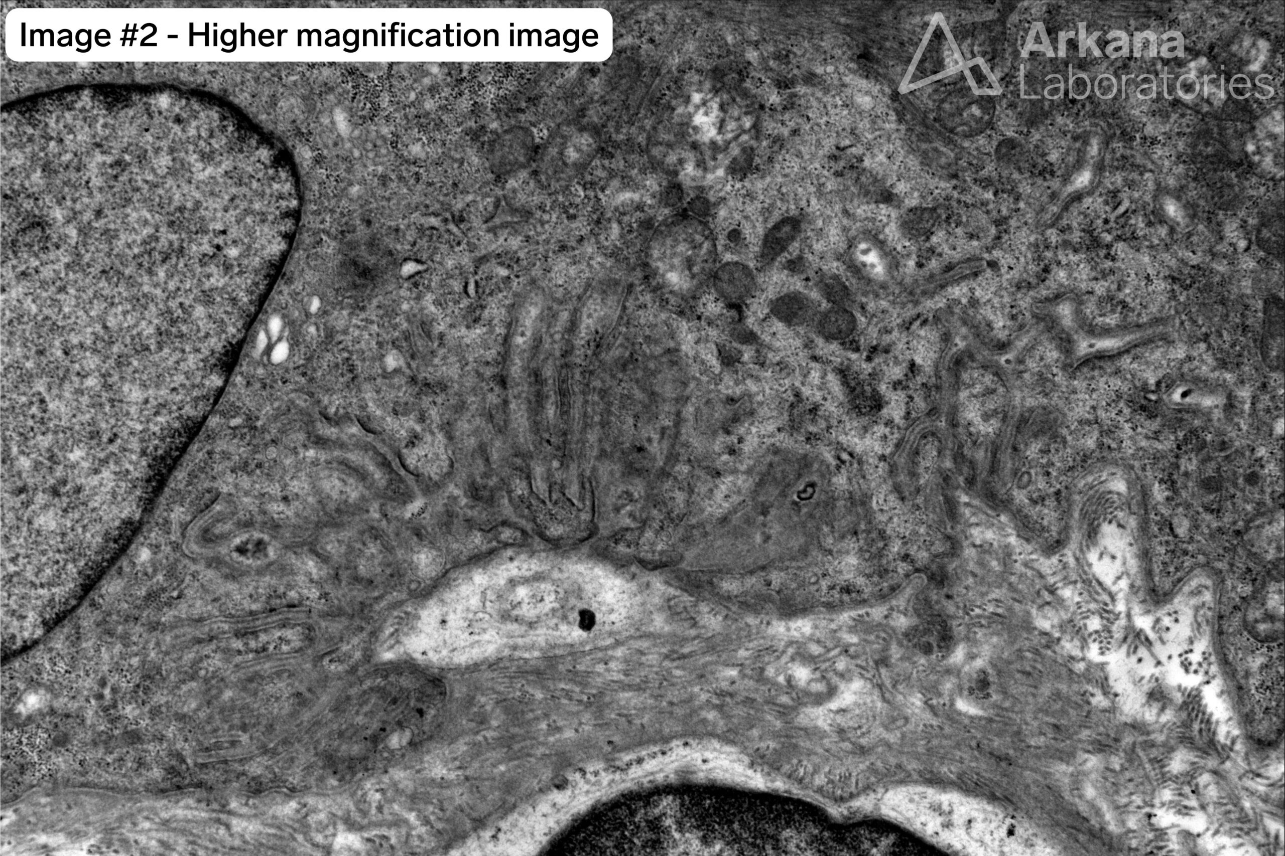 denervated neuromuscular junctions 1 wtmk