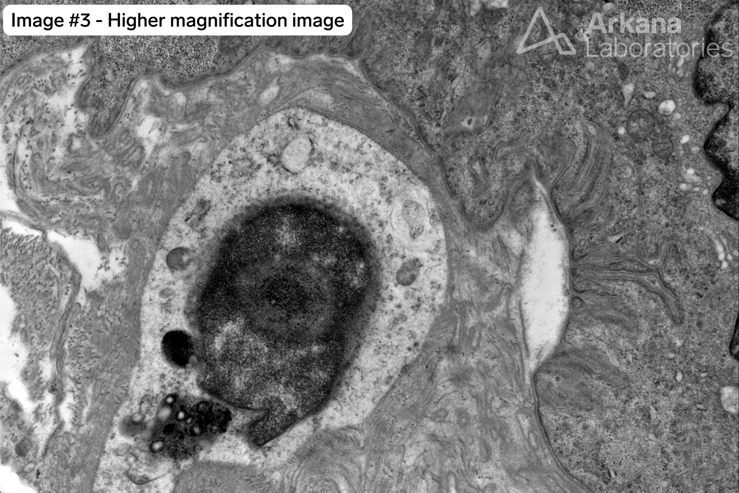denervated neuromuscular junctions 1 wtmk
