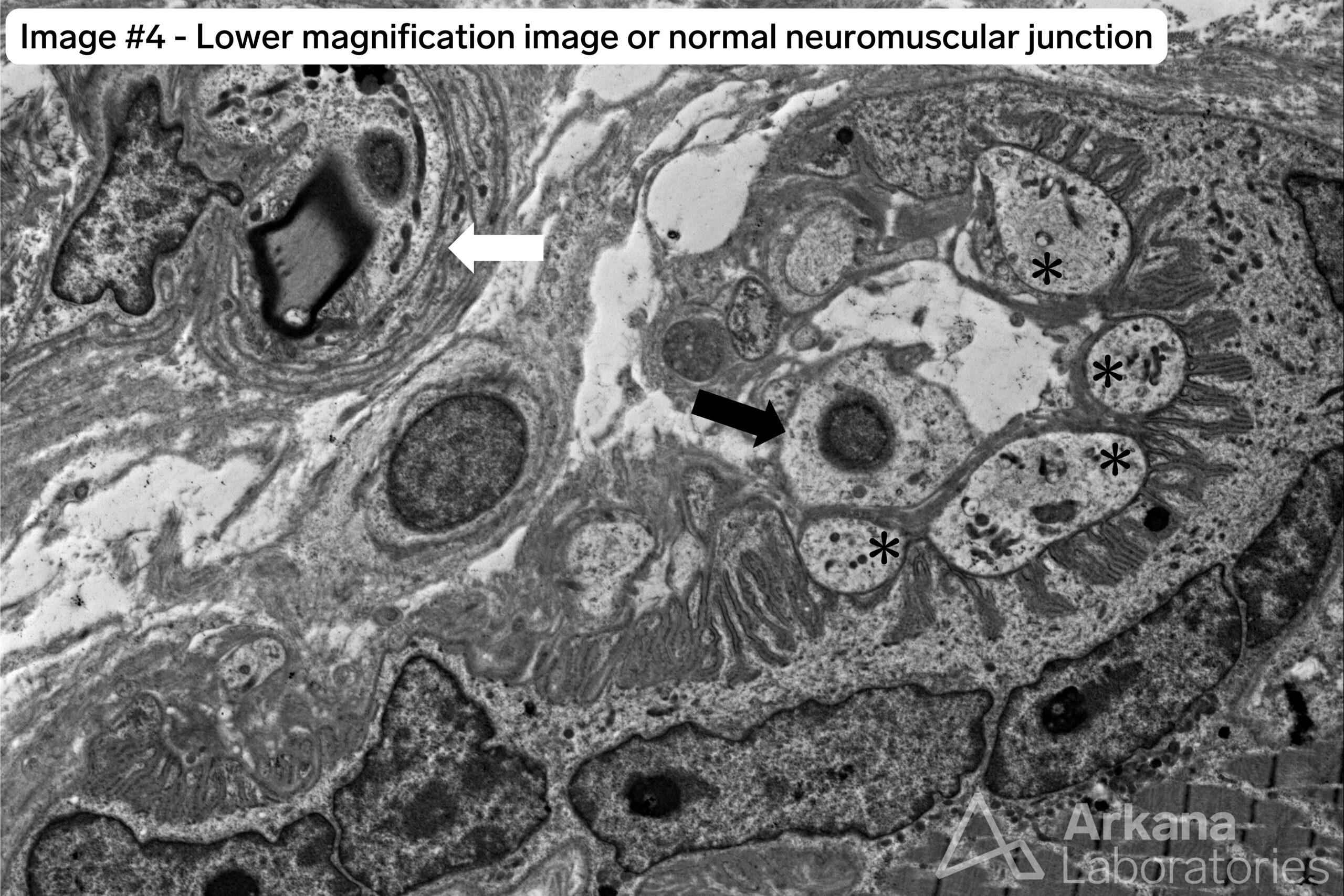 denervated neuromuscular junctions 1 wtmk