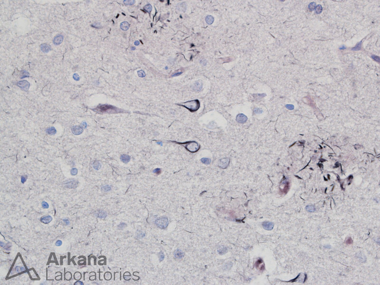 gallyas stain alzheimer's wtmk