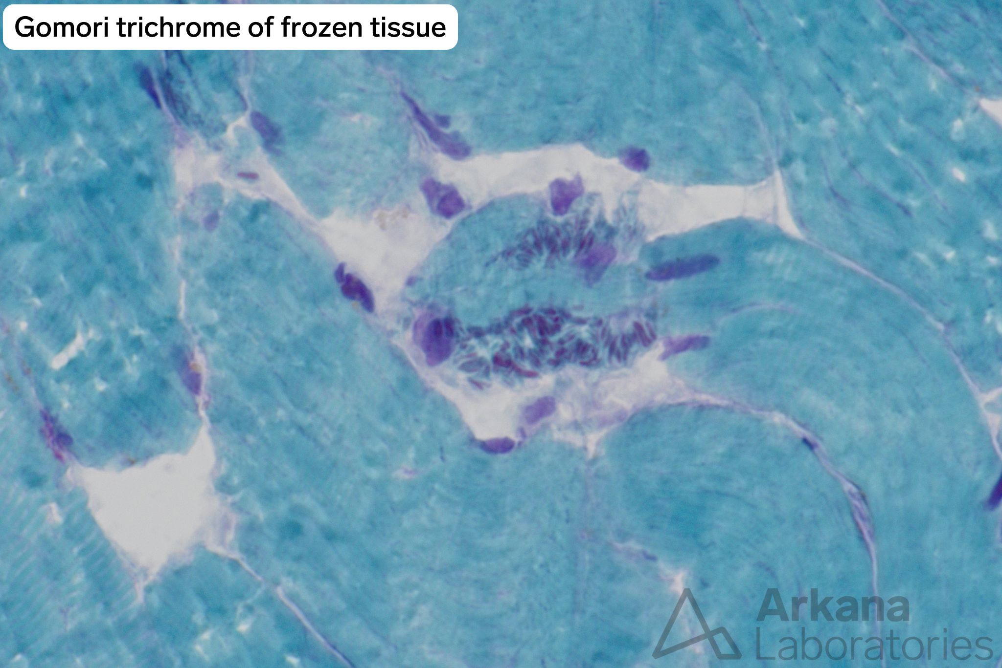 gomori trichrome of frozen tissue