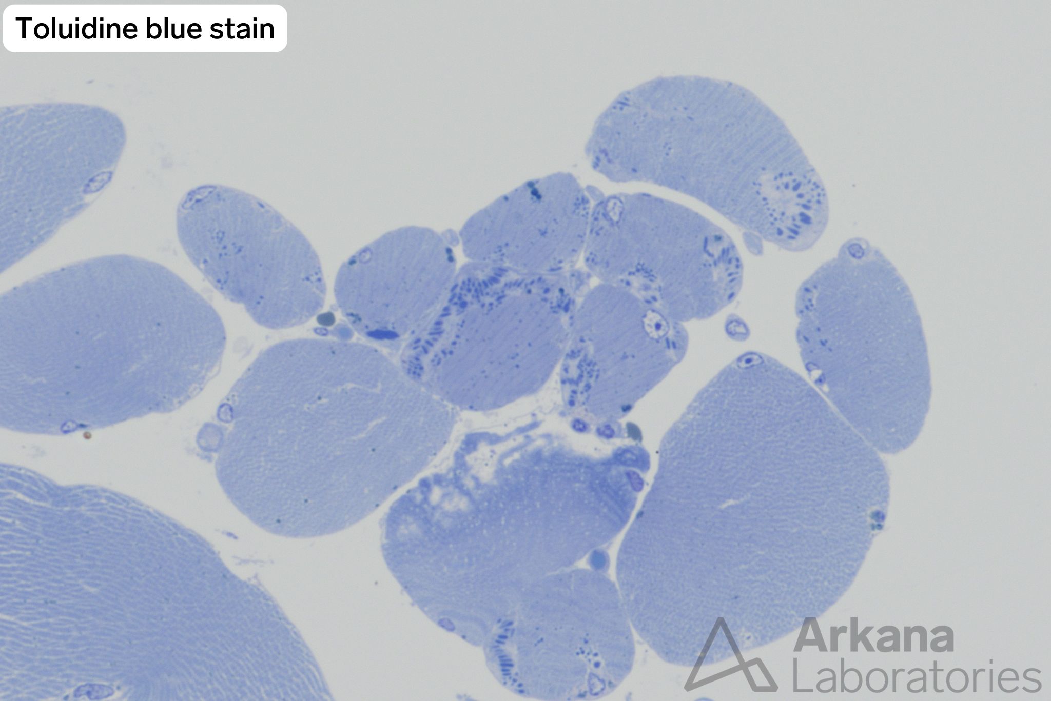 toluidine blue stain