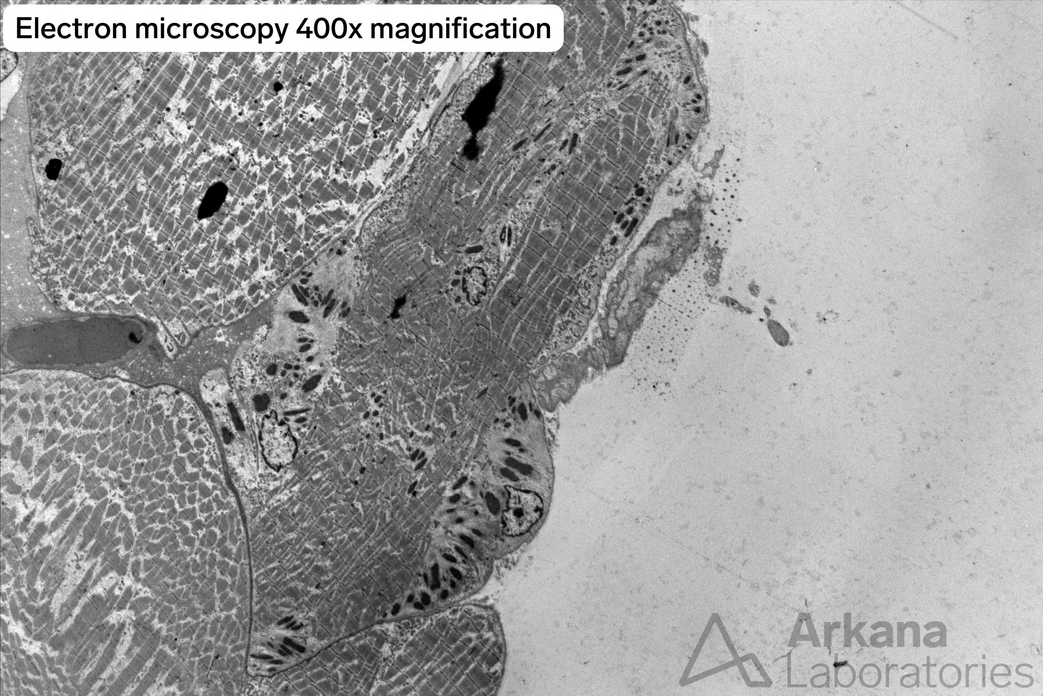 electron microscopy 400x magnification