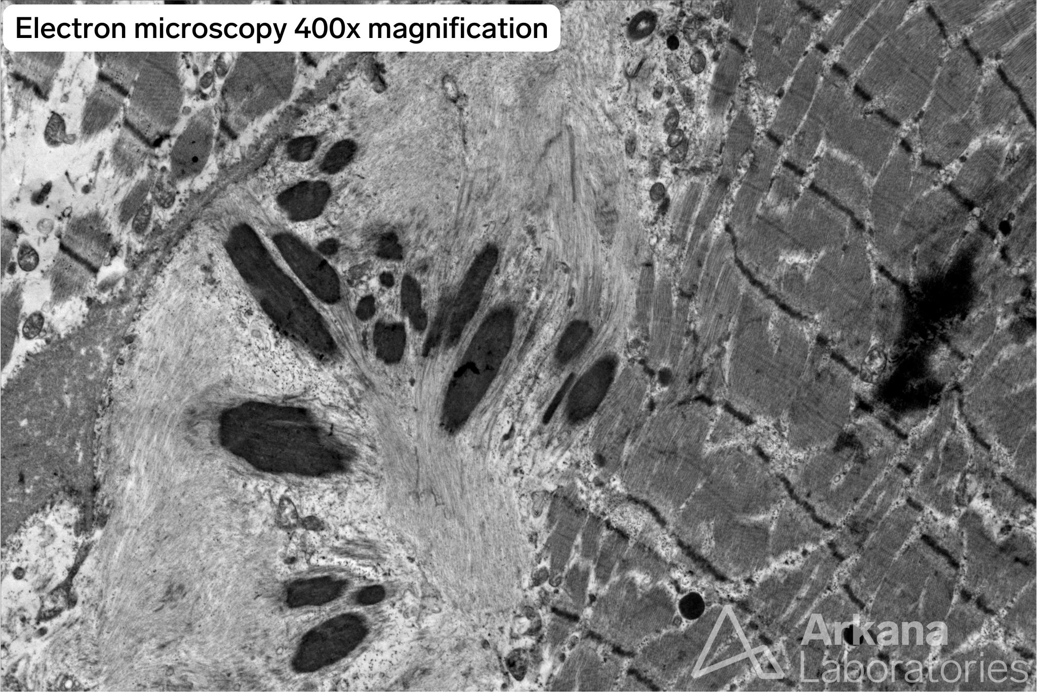electron microscopy 400x magnification