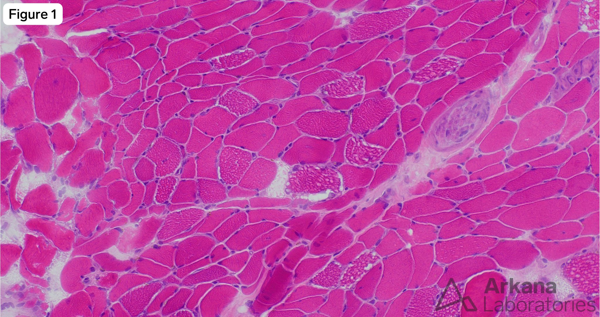 Figure 1: H&E stained section of frozen muscle specimen