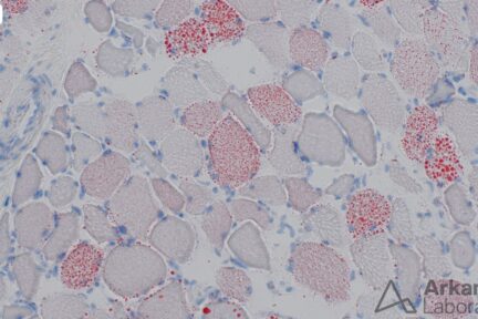 Figure 2: Oil-red O stained section of frozen muscle specimen