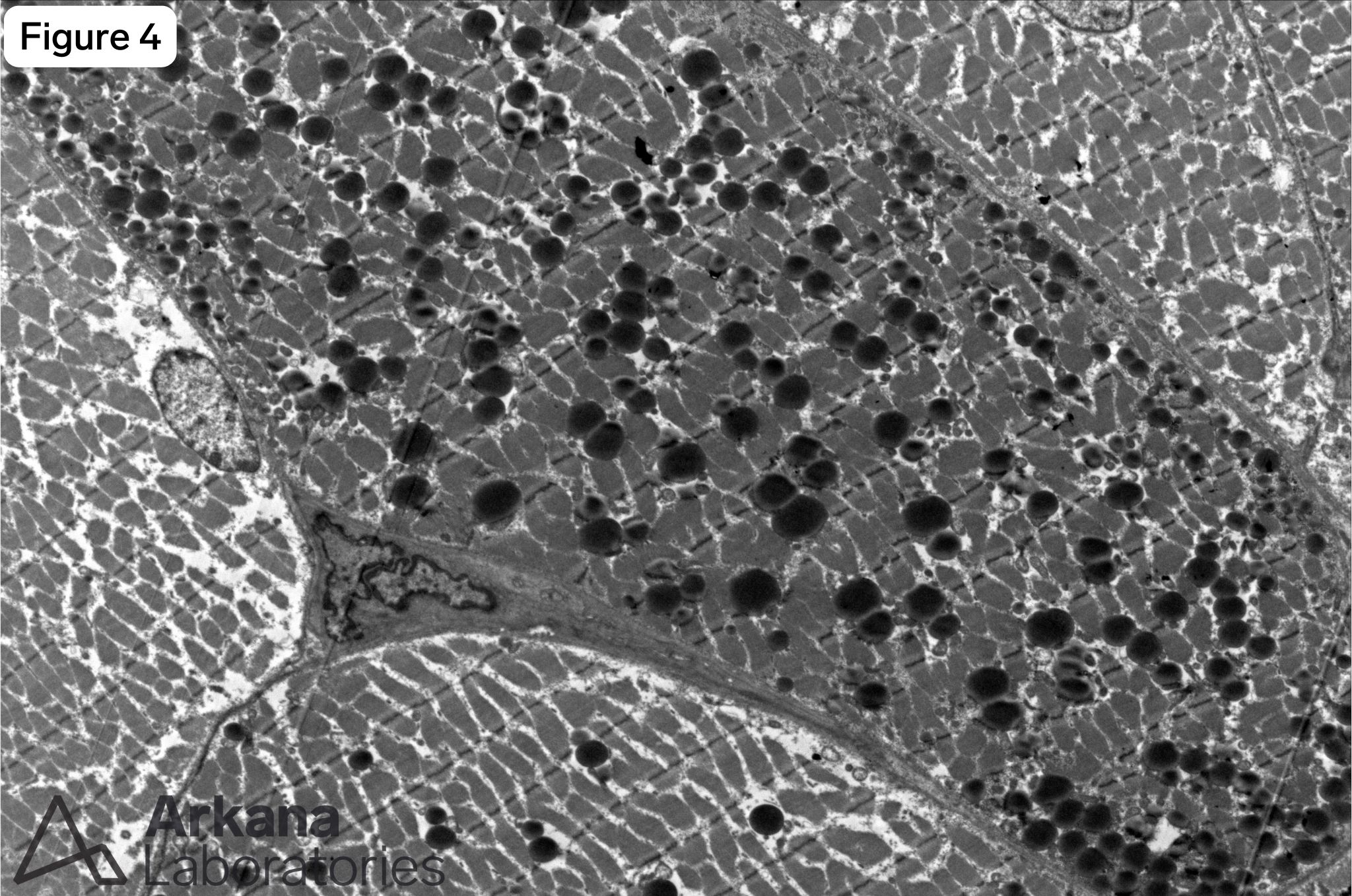 Figure 4: Electron microscopic evaluation for ultrastructural features