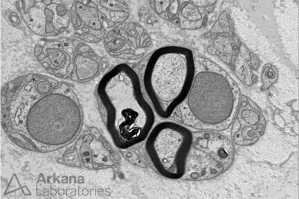 regenerated cluster electron microscopy image