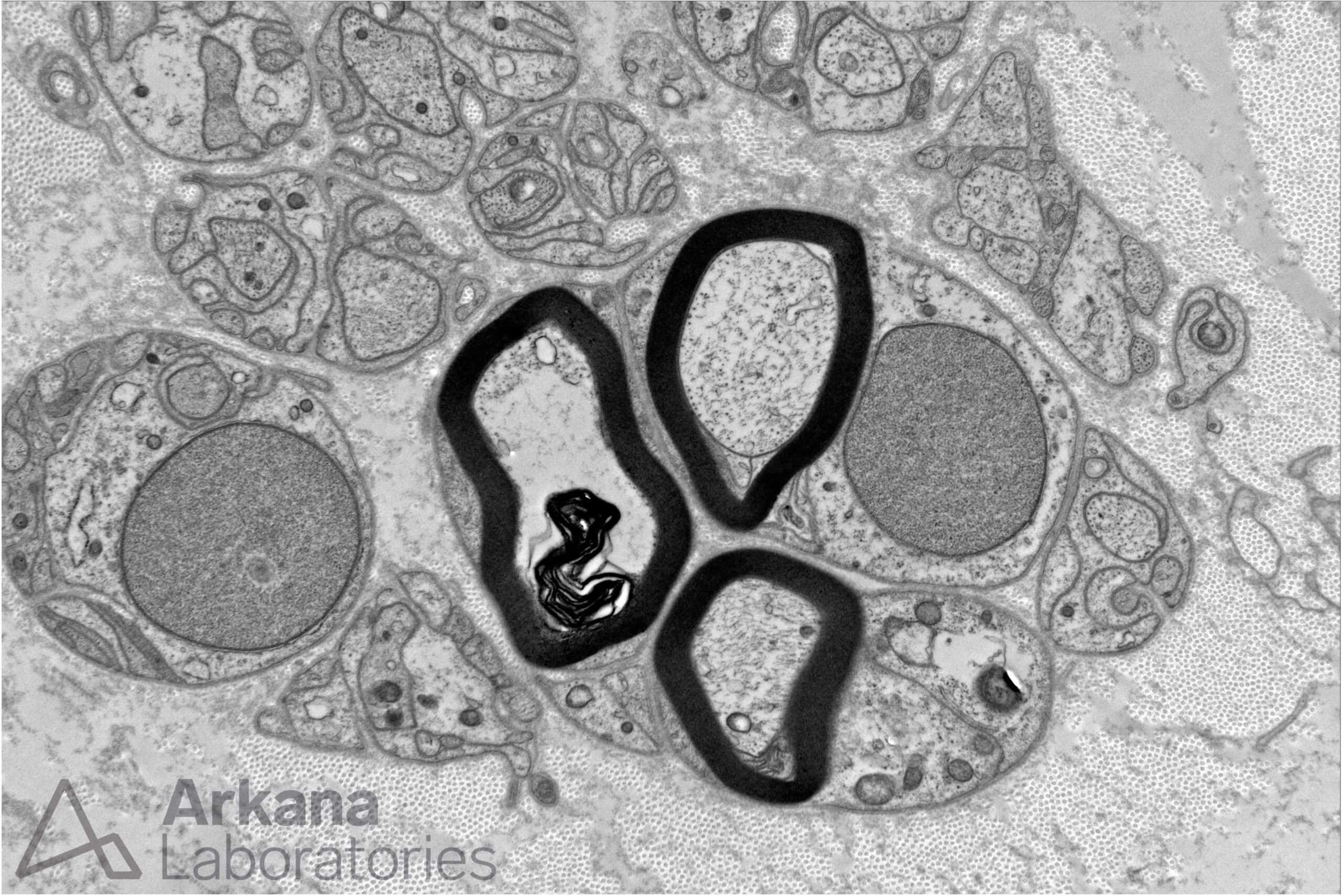 regenerated cluster electron microscopy image