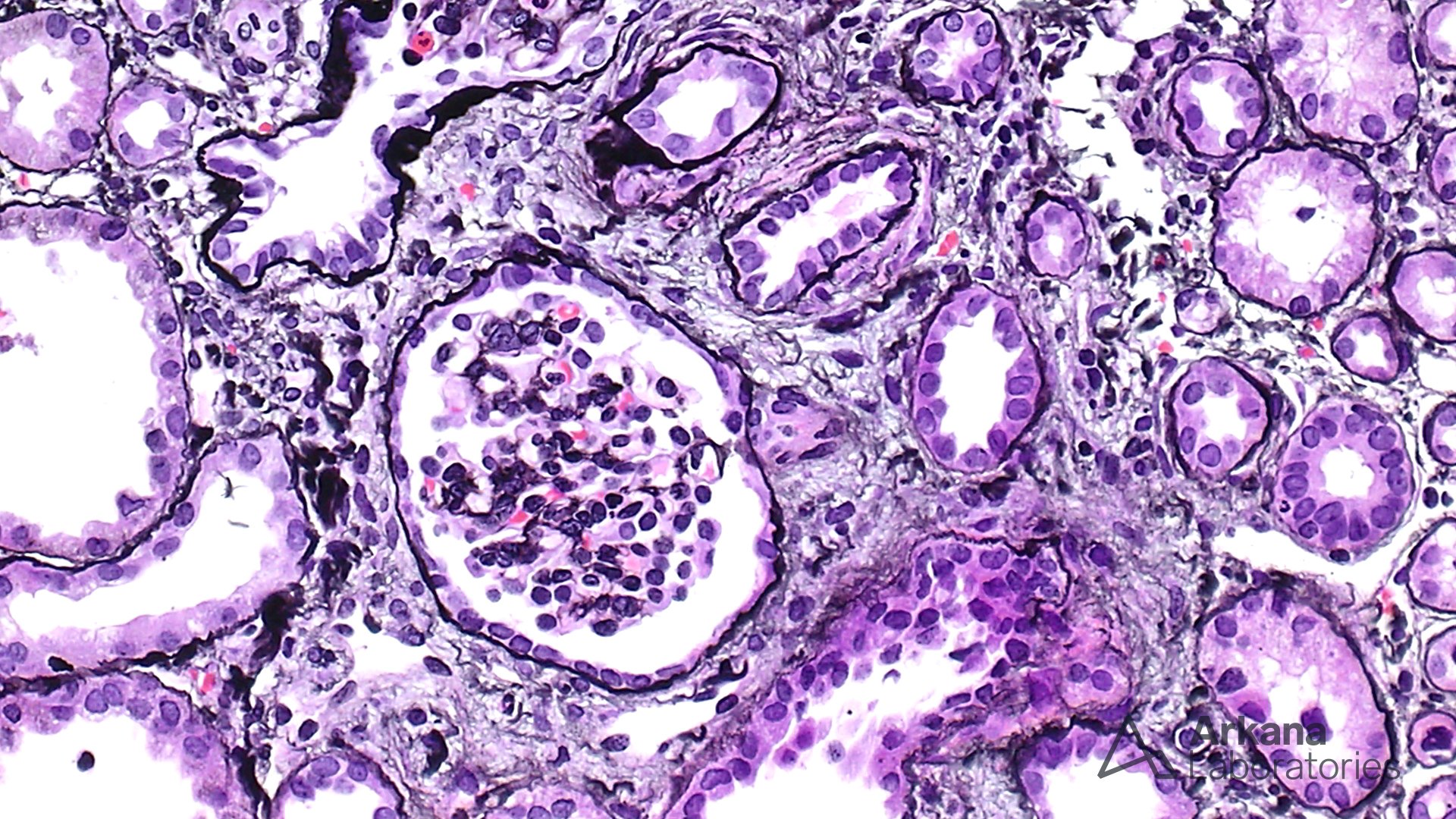 glomerulus in h&e stain