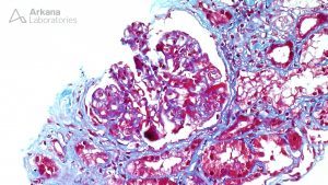 Trichrome stain showing glomerulus