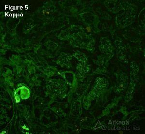 Negative Kappa staining in tubular droplets