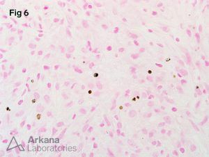 renal biopsy image