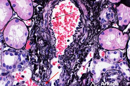 The image captures the transition of an arteriole (arteriole transition)