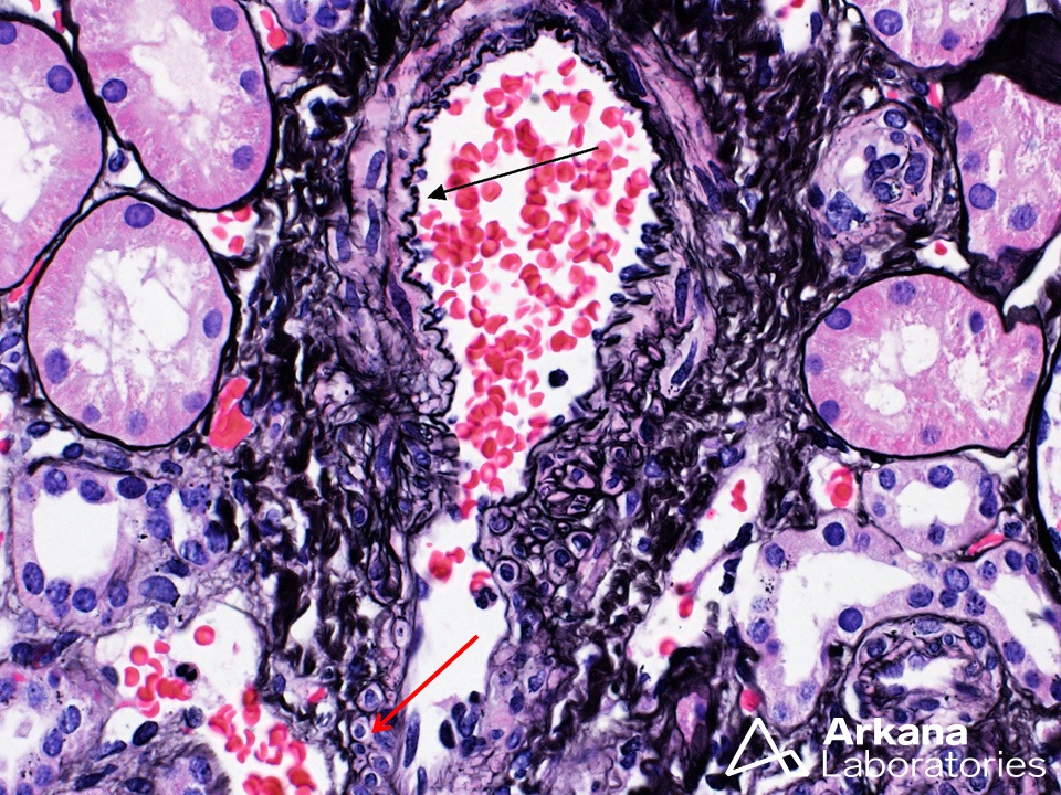 The image captures the transition of an arteriole (arteriole transition)