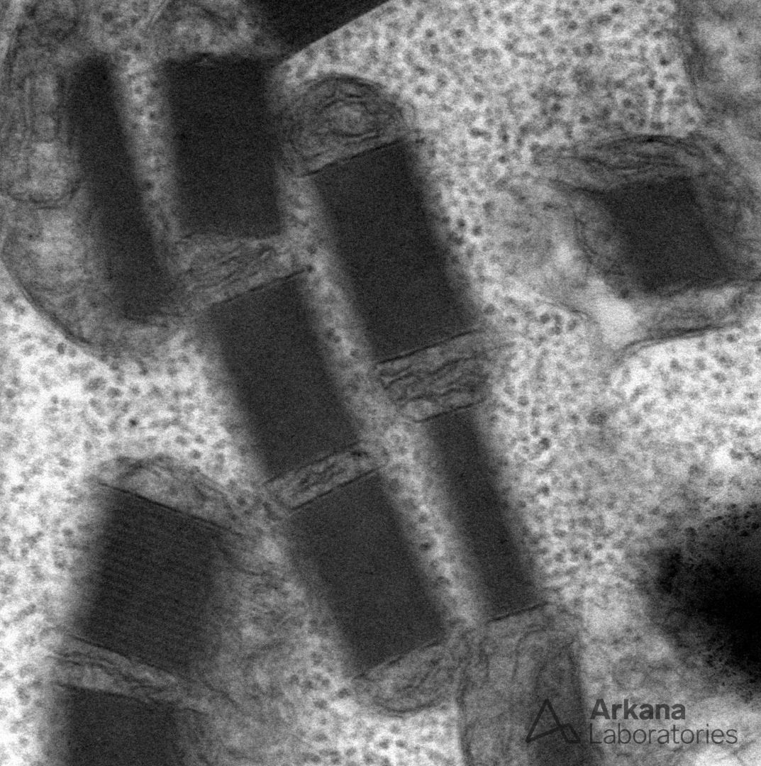 Mitochondrial Inclusions